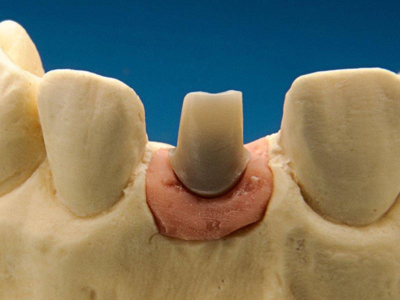 Dentaltechnik Pic
